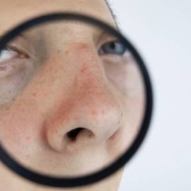 Leczenie tłustej skóry twarzy u mężczyzn w post-inkluzywnych, neutralnych pod względem płci czasach