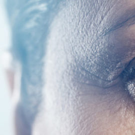 Eyebrow loss menopause