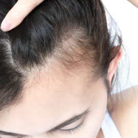 Productos para acelerar el crecimiento del cabello que cuidan del cuero cabelludo y promueven el envejecimiento saludable