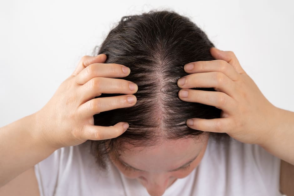 Fase anágena: mujer comprobando su cuero cabelludo