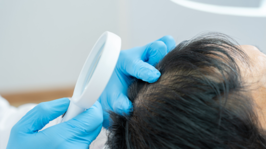 Damaged hair cuticle