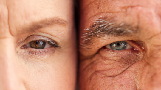 Deregulated nutrient sensing_ accelerates aging